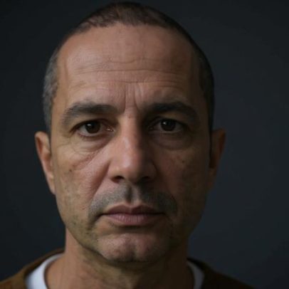 Falso médico de glúteos e seios é preso em Goiás por deformação de paciente