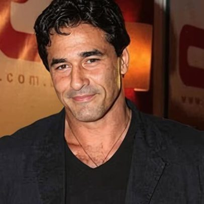 Luciano Szafir revela resultado de harmonização facial ao vivo na TV
