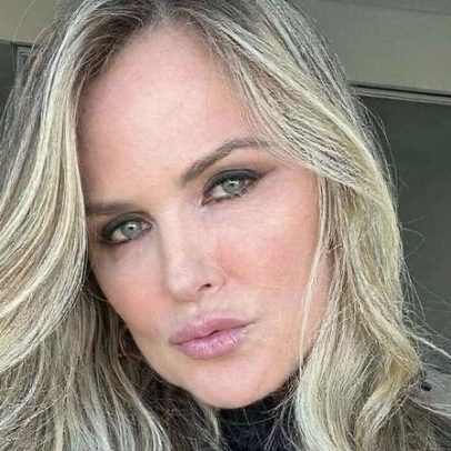 Susana Werner mostra 1º dia de tratamento para emagrecimento nos EUA