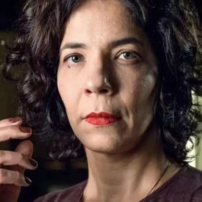Atriz Fernanda D'Umbra lança vaquinha para câncer e recebe apoio de famosos