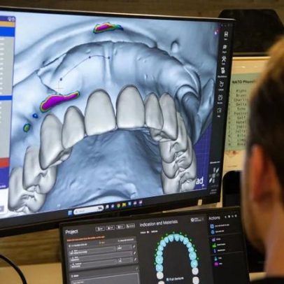 Jovem engenheira imprime dentadura 3D e devolve sorriso a quem precisa