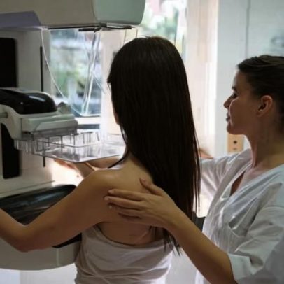 IA identifica pacientes com câncer de mama que podem evitar quimioterapia