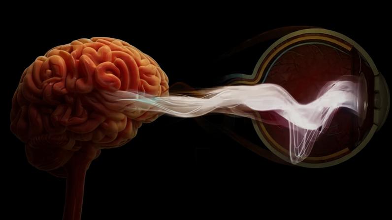 Transtorno do espectro da neuromielite óptica (NMOSD) é uma doença auto-imune em que os anticorpos causam um ataque à medula espinhal e ao nervo que conecta o olho ao cérebro
