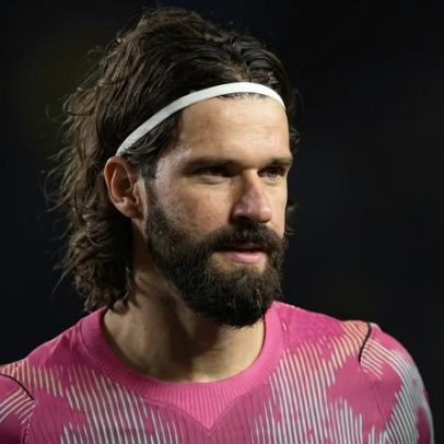 Dermatologista explica vermelhidão no rosto de Alisson Becker e cuidados