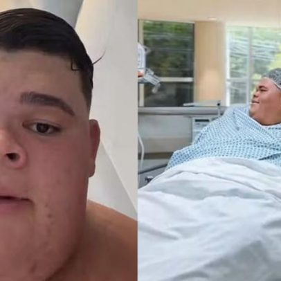 Gordão da XJ revela mudanças físicas após perder 130 kg