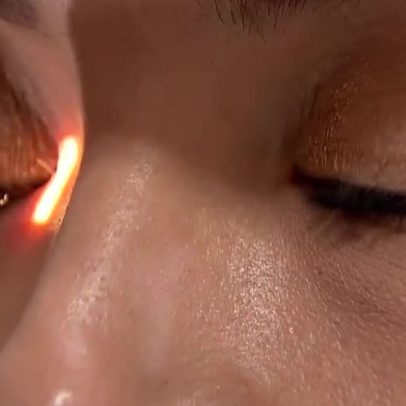 Técnica israelense detecta alterações no organismo por meio dos olhos