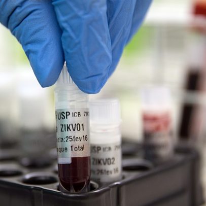 CNJ emite nota criticando barreiras do INSS a vítimas da Zika