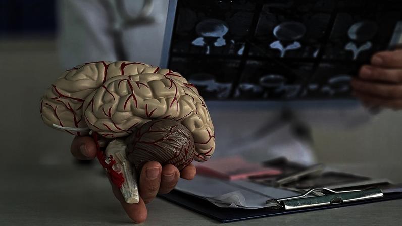 Paciente passou por seis atendimentos antes de exame identificar tumor cerebral.