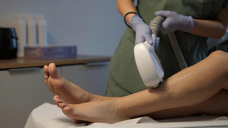 Cliente sofreu queimaduras ao realizar sessão de depilação a laser.
