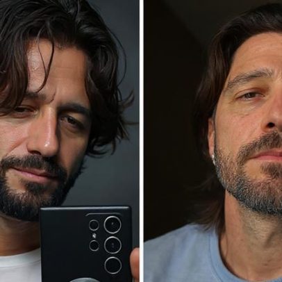 Ex-Malhação Diogo Venturieri relata acidente com piercing na Hora H