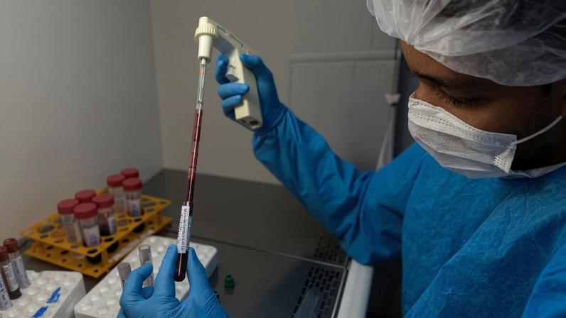 SpiN-TEC é desenvolvida no laboratório CTVacinas localizado no Parque Tecnológico de Belo Horizonte