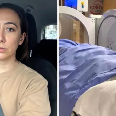Ju Massaoka inicia nova fase de tratamento após infecção grave no nariz