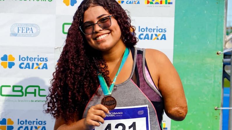 Imagem colorida, Justiça nega indenização a vítima de tubarão em PE: "Assumiu o risco"- Metrópoles