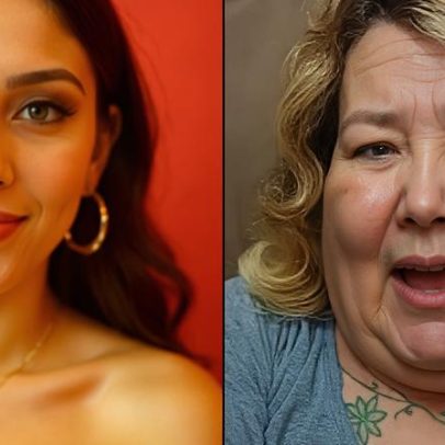 Juju do Pix revela resultado após seis meses de reconstrução facial