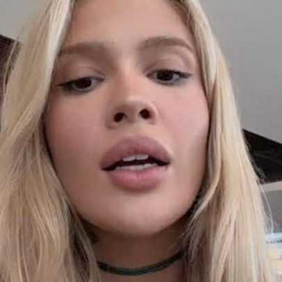 Karoline Lima mostra ferimentos nos pés após cobertura da Copa