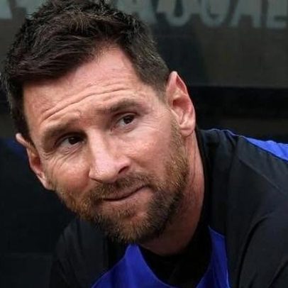 Argentina enfrenta desafio de evitar nova recaída na lesão de Messi