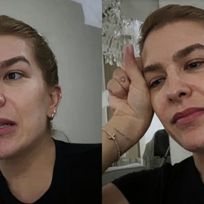 Lorena Improta relata complicações pós-parto e sofrimento