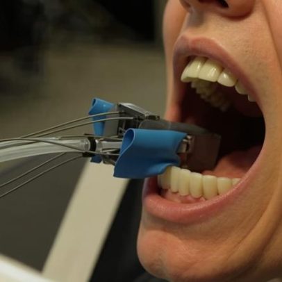 Mini-robô dentista atua dentro da boca e facilita tratamentos complexos