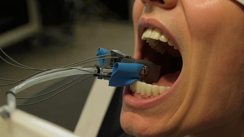 Um robô em miniatura desenvolvido na Universidade de Basel, na Suíça, pode ajudar a preparar os dentes para receber uma coroa. Veja a tecnologia em ação — Foto: Universidade de Basileia, Catherine Weyer
