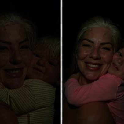 Mãe e filha com condição genética rara chamam atenção