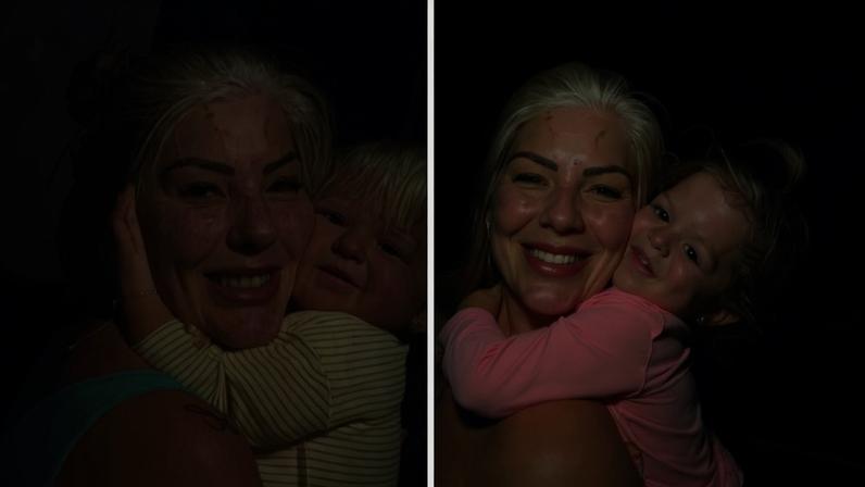 Pamella e a filha Vitória compartilham a mesma condição genética, o piebaldismo — Foto: Reprodução/ Instagram