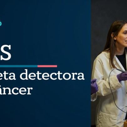 CAS discute inovação em diagnóstico oncológico ao vivo