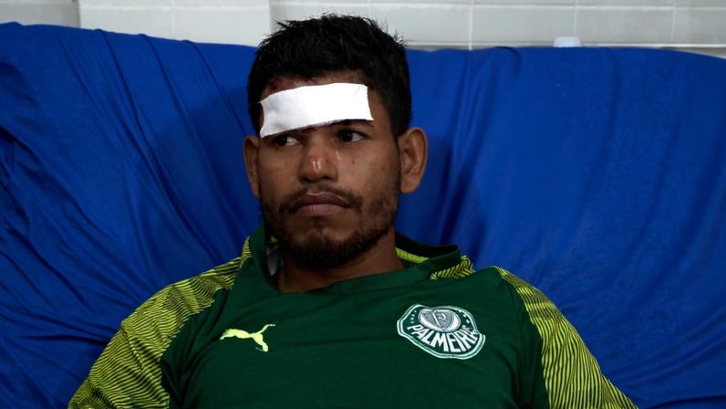 Weverton Murieta é um dos quatro feridos em desabamento de ponte no AC — Foto: Reprodução/Secom-AC