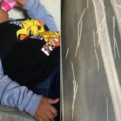 Mulher que fingia ter 12 denuncia família por abusos e agulhas no corpo