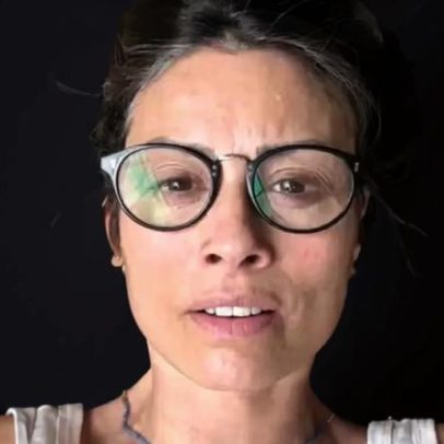 Apresentadora revela doença autoimune e comove fãs ao mostrar falhas no cabelo