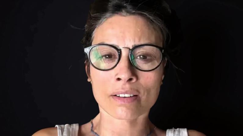 Ex-apresentadora britânica Melanie Sykes, de 55 anos, comoveu seguidores ao compartilhar um vídeo nas redes sociais em que mostra a perda de cabelo causada pela alopecia