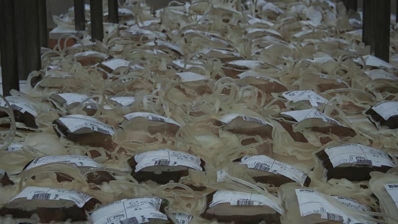A articulista afirma que em termos de saúde pública, o procedimento invasivo, caro e arriscado para retirada de microplásticos é impensável; na imagem, bolsas de sangue