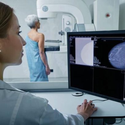 ANS defende cobertura obrigatória de mamografia digital pelos planos de saúde