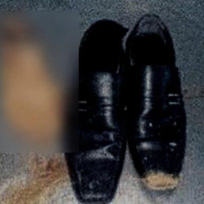 Homem é preso após amputar o pé para receber seguro de R$ 1,5 milhão