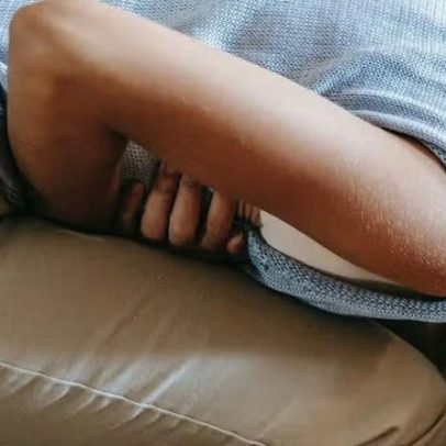 Estudo genético sobre endometriose revela que a doença vai além da ginecologia