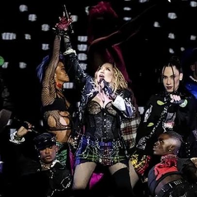 Madonna revela joelho ruim após anos se apresentando de salto alto