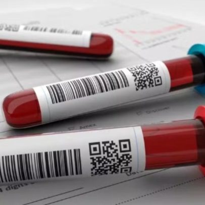 SUS incorpora novo tratamento para leucemia mieloide aguda em adultos