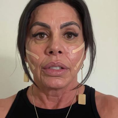 Gretchen mostra resultado de novo procedimento estético para saúde na velhice