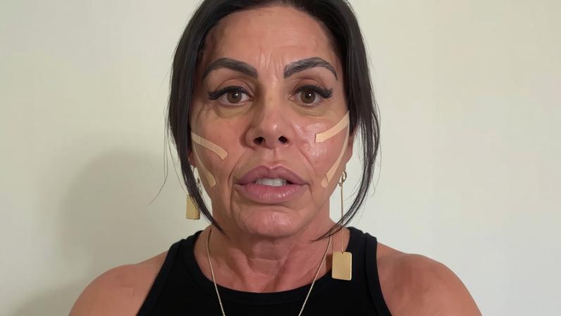 Gretchen mostra resultado de novo procedimento estético: 'Ser saudável na velhice'