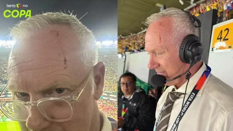 Comentarista sofre corte na cabeça após garrafa atingir ao vivo na Copa