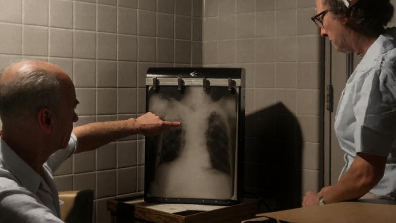 A persistência da tuberculose não se explica pela falta de tratamento, mas por uma combinação de fatores