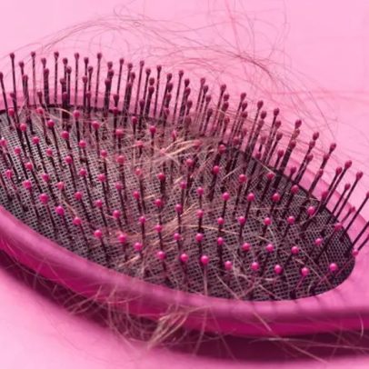 Descoberta revolucionária sobre queda de cabelo pode impactar mulheres