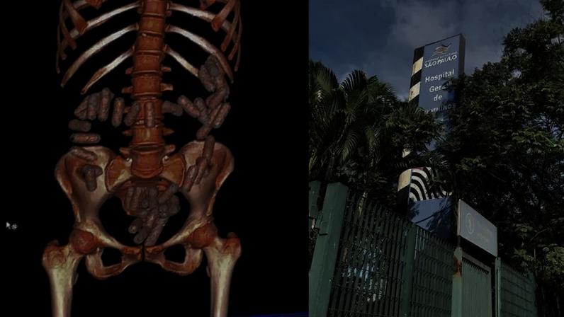 Hospital das Mulas do Tráfico tem ala exclusiva para pacientes