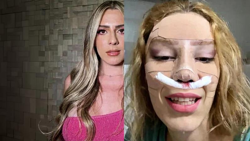 Veja as primeiras fotos de Malévola após cirurgia de R$ 80 mil