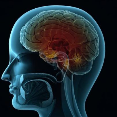 Principais sintomas da meningite e formas de prevenção
