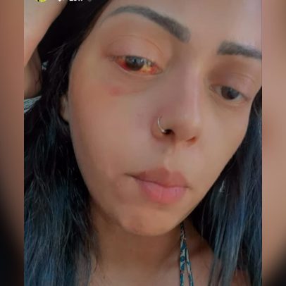 Mulher relata emboscada cruel do ex-namorado em MG