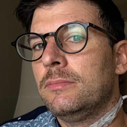 Ator de The Pitt revela câncer ligado ao HPV e alerta para exames e vacinação