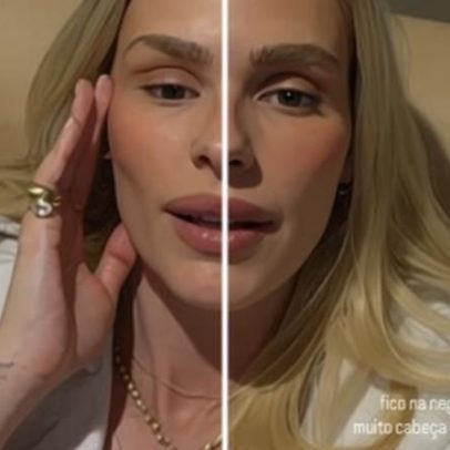 Yasmin Brunet relata crise de lipedema após comer glúten