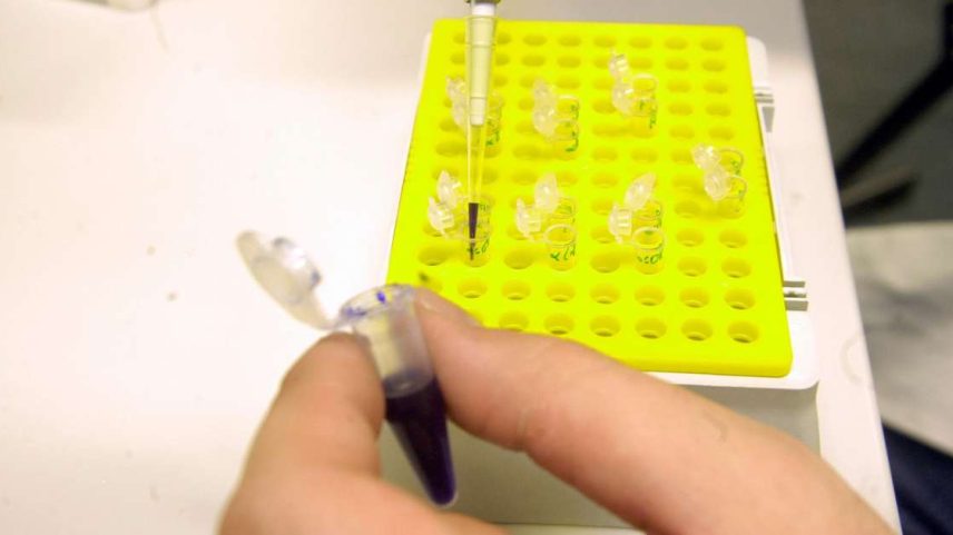 Instituição pesquisa meningococo em um laboratório