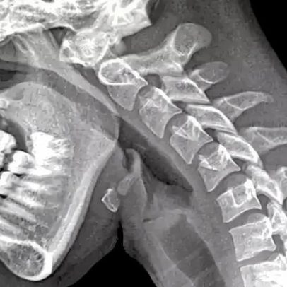 Mãos fracas e visão turva: estamos ficando com o 'corpo de celular'?