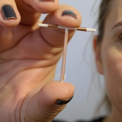 Estudo aponta dor intensa na inserção de DIU em 8 em cada 10 mulheres